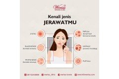 Kenali jenis jerawat